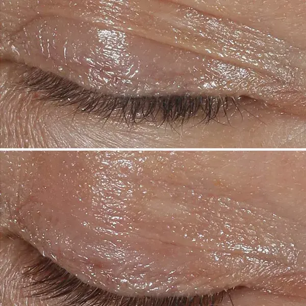 Clinique Smart Clinical Repair Crème Contour des Yeux Correction Rides 15ml