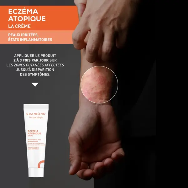 Creme para Eczema GRANIONS - Anti-Coceira - Pele Irritada - Sem Cortisona - 30ml