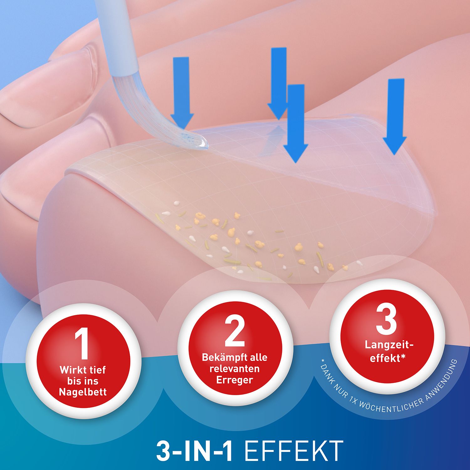 Loceryl® Nagellack gegen Nagelpilz mit DIREKT-Applikator