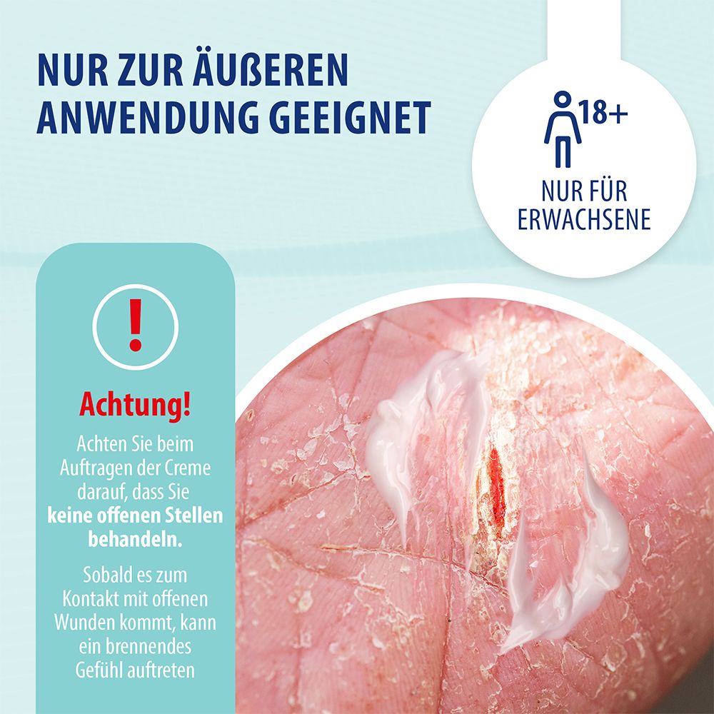 Behrend – Schuppenflechte & Neurodermitis Creme bei geröteter, trockener & schuppiger Haut – Psoriasis & Ekzem Salbe reduziert den Juckreiz & beruhigt entzündete Haut
