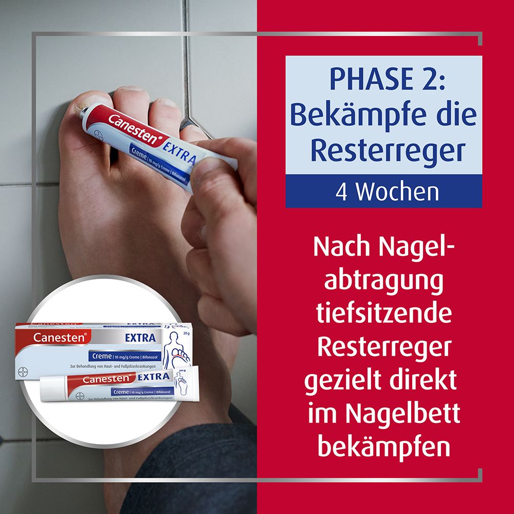 Canesten® EXTRA 2-Phasen-Kurztherapie-Set bei Nagelpilz