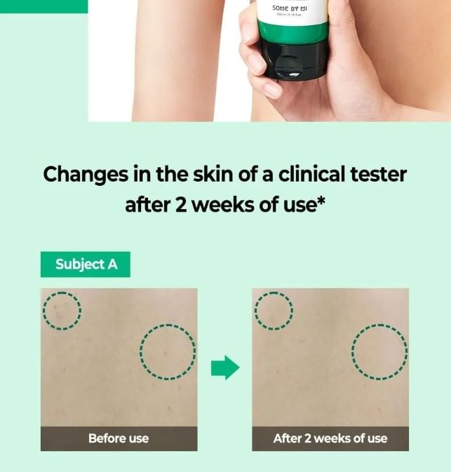SOME BY MI - AHA, BHA, PHA Miracle Kalmerende Bodylotion