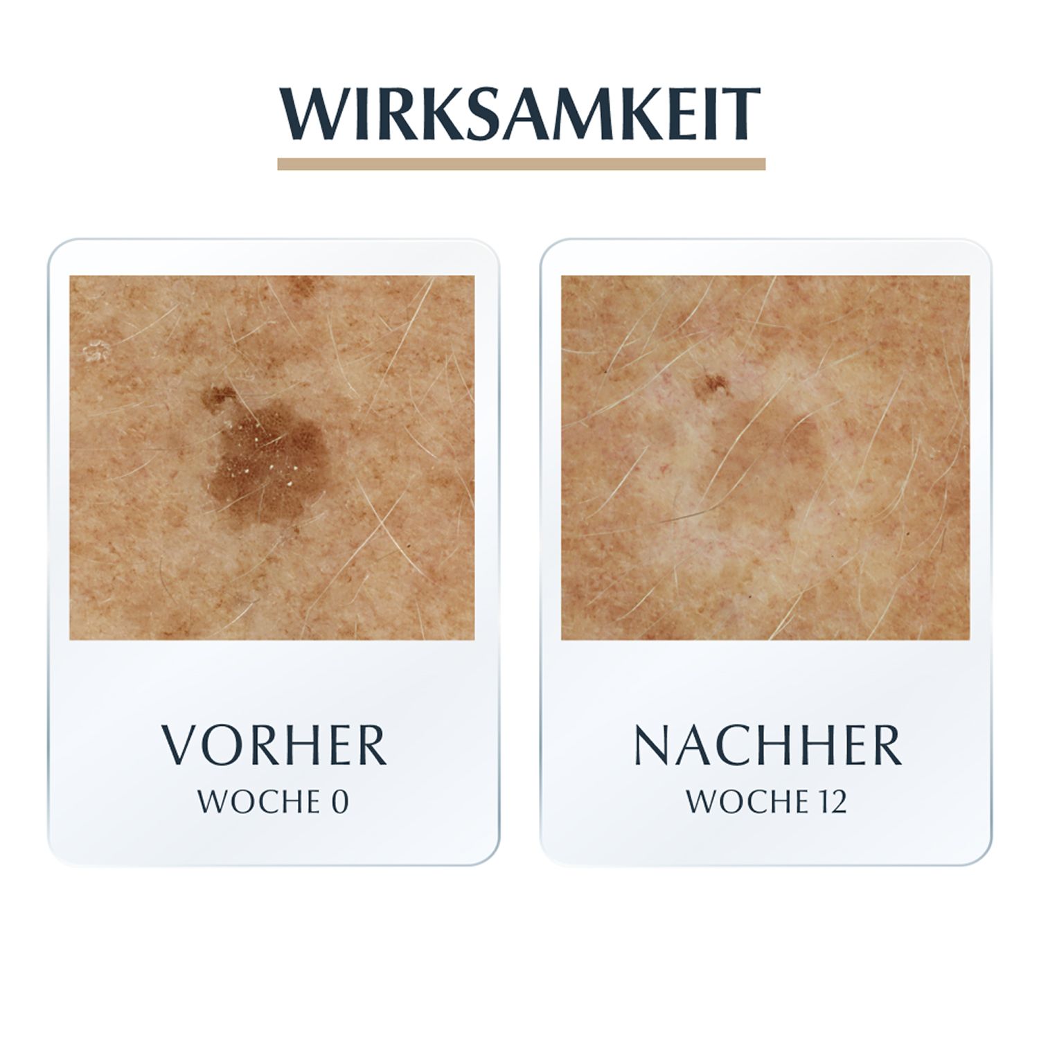 Eucerin® HYALURON-FILLER + ELASTICITY 3D Serum – Anti-Aging Serum für reife Haut – Hautpflege gegen Altersflecken und Falten