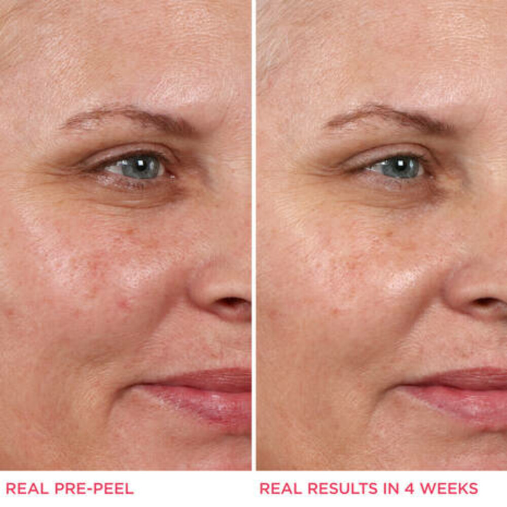 IT Cosmetics Hello Results BabySmooth Glycolic Peel + Carin Oil30 ml