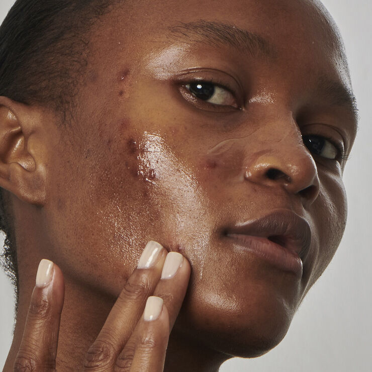 THE INKEY LIST Excess oil solution with 20% niacinamide - Face serum