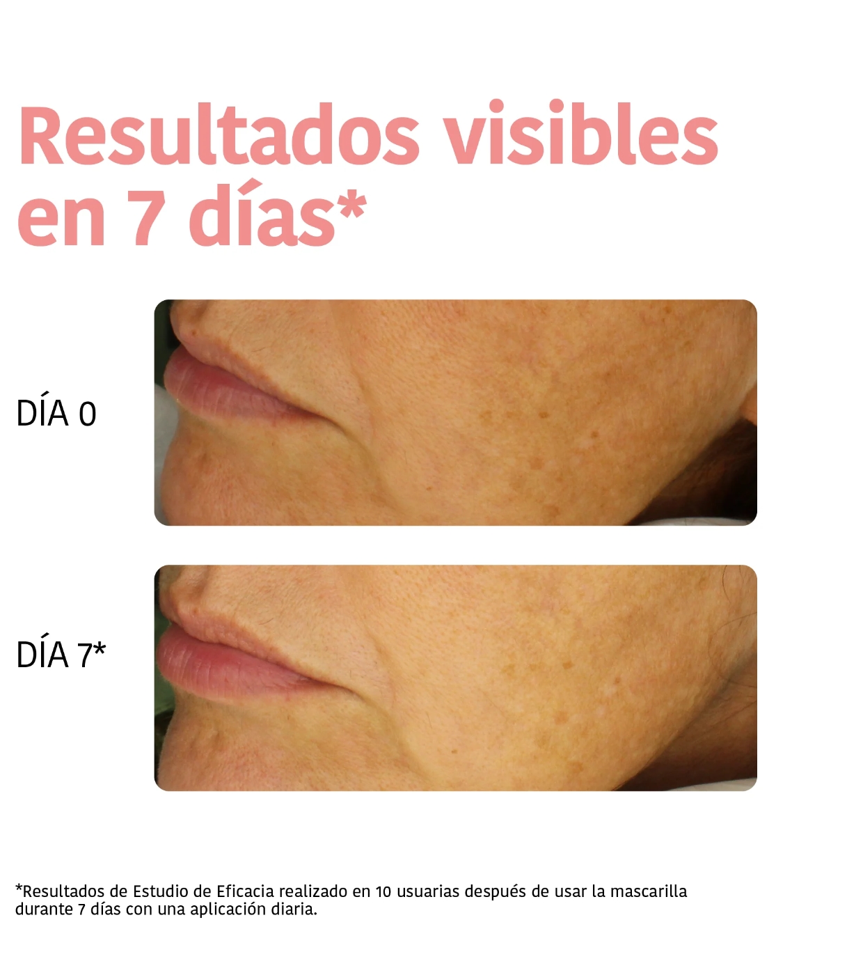 Iroha Nature - Máscara Facial Iluminadora e Hidratante - Vitamina C + Ácido Hialurônico