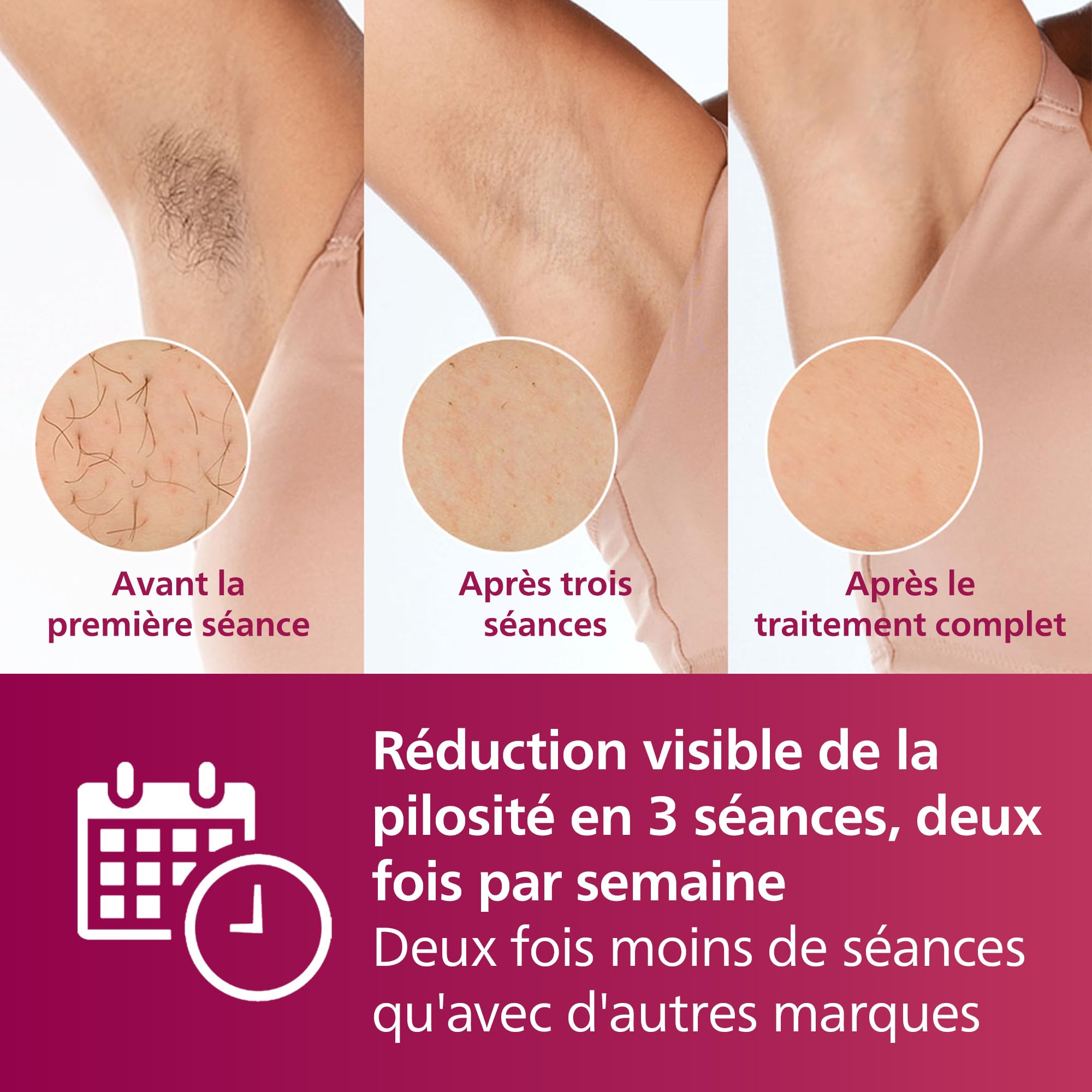 Philips Lumea série 7000, Épilateur à lumière pulsée, alternative à l'épilation laser, 3 embouts pour le corps, le visage et le maillot, modèle SC1999