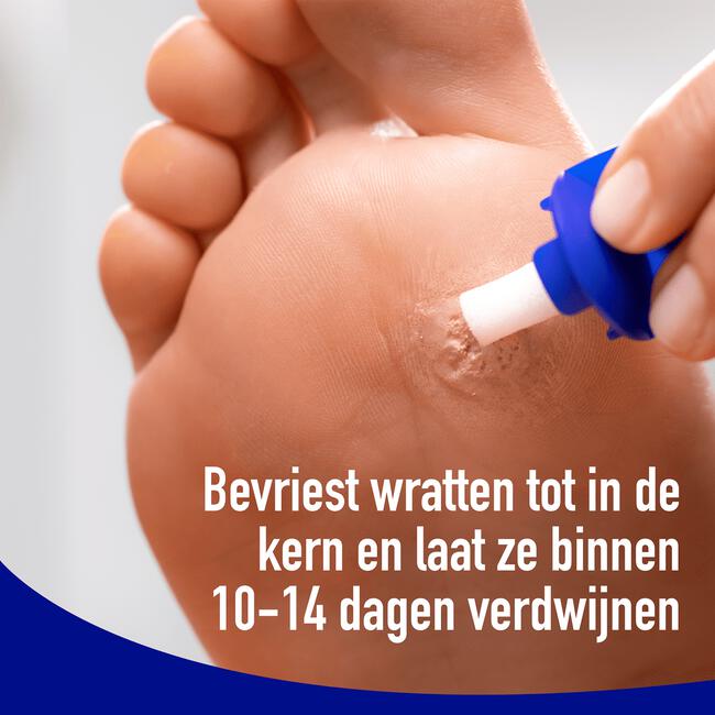 Wartner Wrattenverwijderaar 50 ML