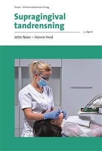 Supragingival tandrensning