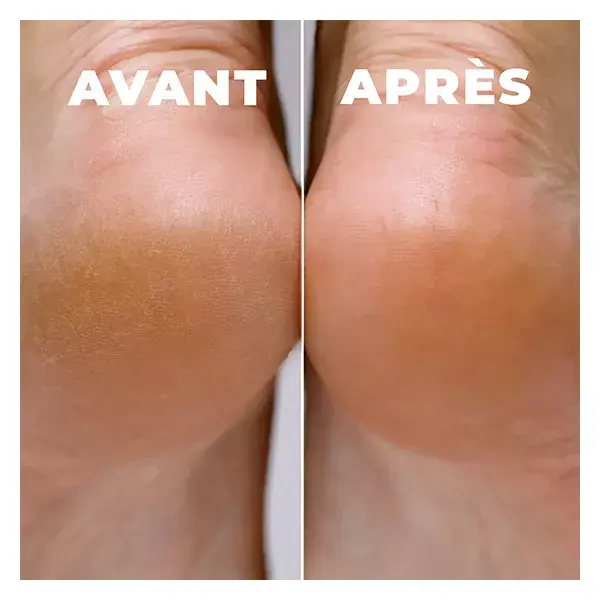 Óleo para os pés Energie Fruit Soft, certificado orgânico pela Ecocert, 100ml