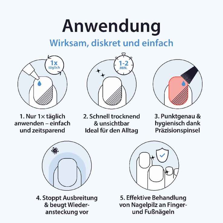 Acetocaustin Nagelpilz Lösung mit Aufhellung, 9 ml