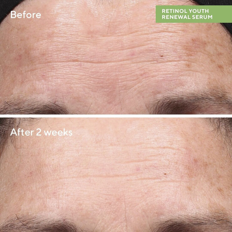 Murad Retinol Youth Renewal Serum