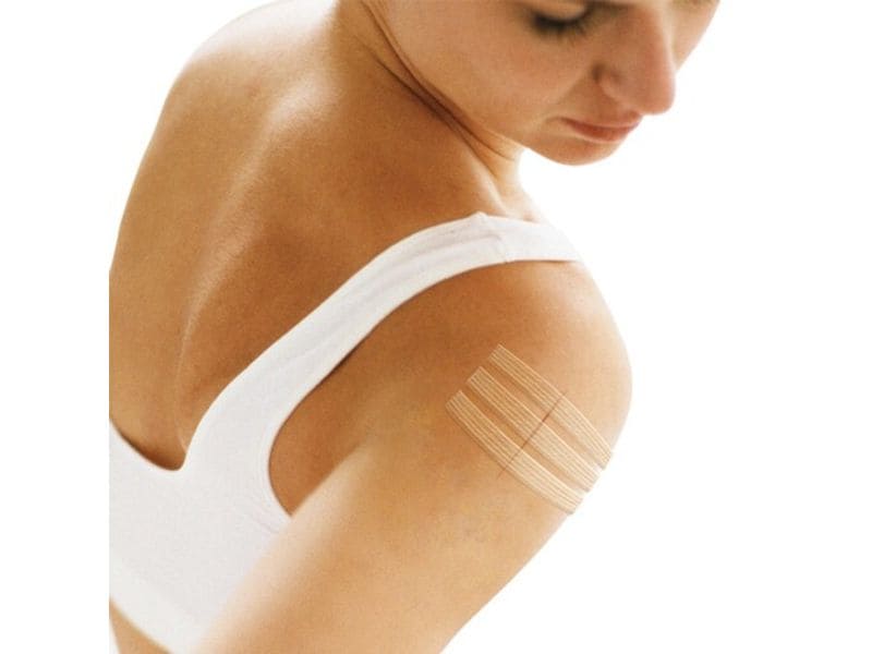3M Nexcare Steri-Strip Wundverschlusstreifen weiss, 8 Stück Verschlussstreifen für Wunden