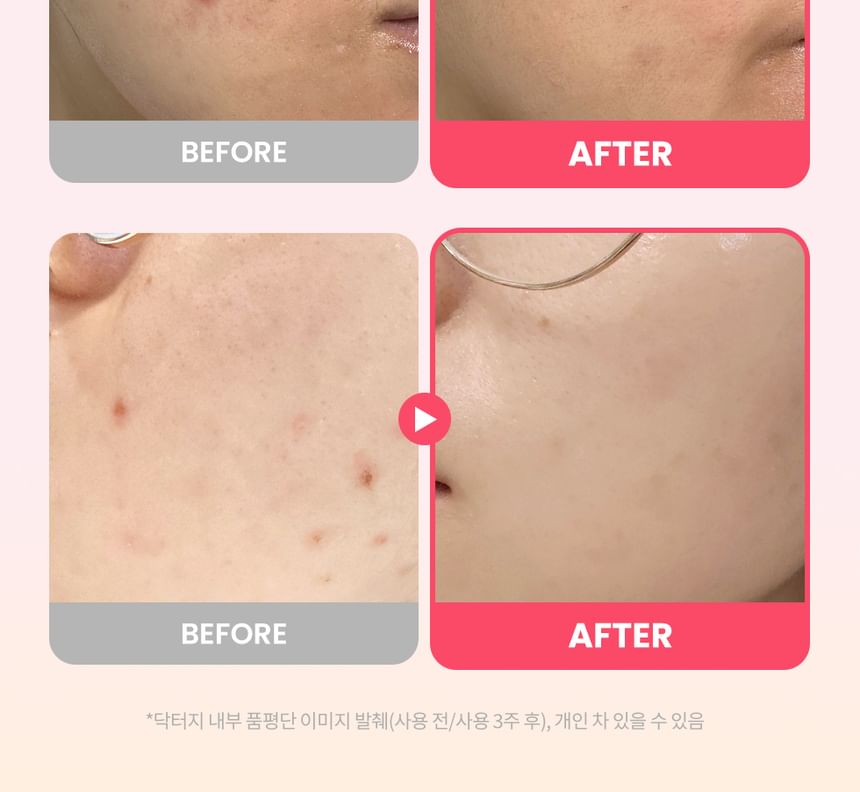 Dr.G - RED Blemish Repair Soothing Cream