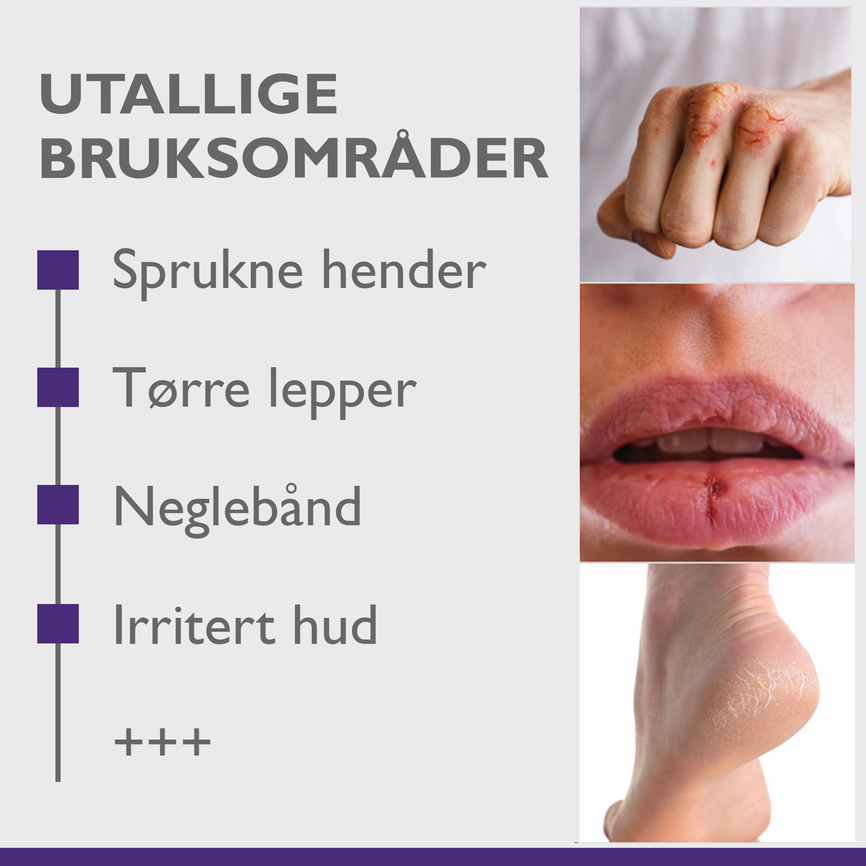 A-Derma Epitheliale A.H Ultra Repair 50 g